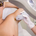 best laser hair removal in Oakville & Mississauga, Canada