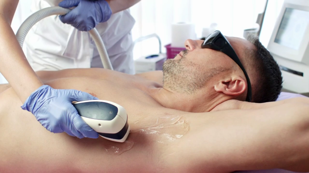Best Laser Hair Removal For Men In Mississauga, Oakville, Milton, Durham, Ontario Canada Video